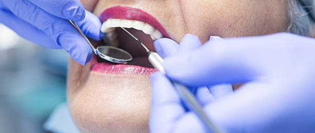 Best Emergency Wisdom Teeth Removal in Yeagertown, PA
